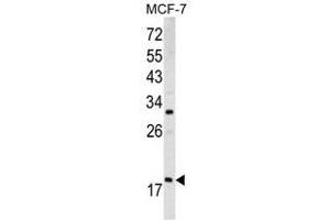 Image no. 1 for anti-ADP-Ribosylation Factor 3 (ARF3) (Middle Region) antibody (ABIN452754) (ARF3 抗体  (Middle Region))