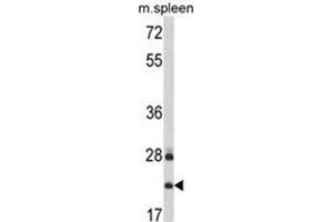 Western blot analysis of VTI1A Antibody (C-term) in mouse spleen tissue lysates (35ug/lane).