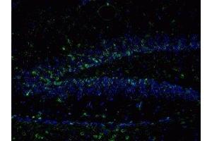 Immunostaining of mouse dentate gyrus 48 hour post TMT treatment showing NR2B when phosphorylated at Tyr1336 in green and nuclei in blue. (GRIN2B 抗体  (pTyr1336))