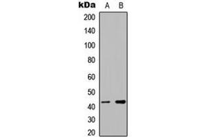 Western blot analysis of hnRNP G expression in Jurkat (A), RT4 (B) whole cell lysates.
