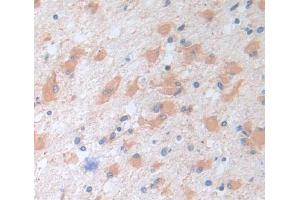 Used in DAB staining on fromalin fixed paraffin- embedded tissue (DARS 抗体  (AA 363-501))