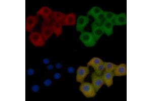 FAS Mouse Monoclonal Antibody staining Hela cells by IF/ICC. (FAS 抗体  (C-Term))