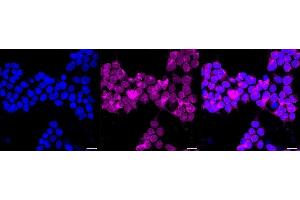 Immunocytochemical staining of Hela cells with PRKCSH antibody (ABIN7799984), 1:1,000). (Recombinant PRKCSH 抗体)
