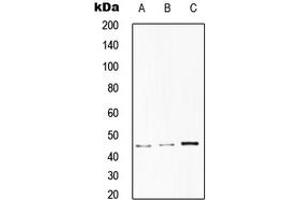 Western blot analysis of CD75 expression in HepG2 (A), HeLa (B), RAW264. (ST6GAL1 抗体  (Center))