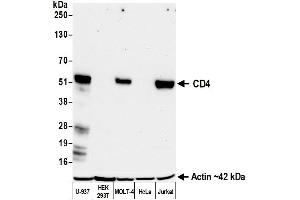 Western Blotting (WB) image for anti-CD4 (CD4) (AA 26-397) antibody (ABIN7455077) (Recombinant CD4 抗体  (AA 26-397))