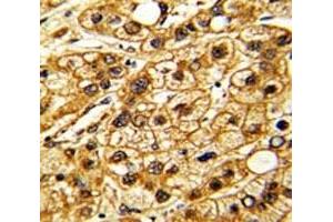 Immunohistochemistry (IHC) image for anti-Integrin, alpha X (Complement Component 3 Receptor 4 Subunit) (ITGAX) (AA 1119-1145) antibody (ABIN3031404)