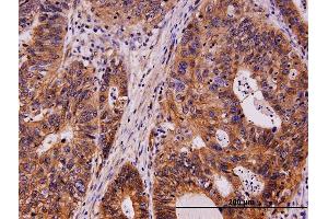 Immunostaining (ISt) image for anti-Mast/stem Cell Growth Factor Receptor (KIT) (AA 41-140) antibody (ABIN561594)