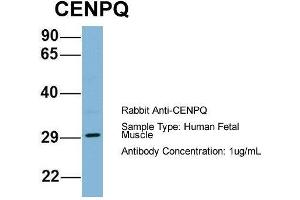 Host: Rabbit  Target Name: CENPQ  Sample Tissue: Human Fetal Muscle  Antibody Dilution: 1. (CENPQ 抗体  (N-Term))
