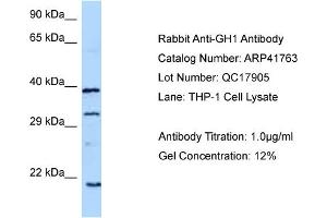 WB Suggested Anti-GH1 Antibody   Titration: 1. (Growth Hormone 1 抗体  (C-Term))