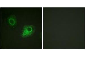 Immunofluorescence analysis of HeLa cells, using VEGFR2 (Ab-1054) Antibody. (VEGFR2/CD309 抗体  (AA 1020-1069))