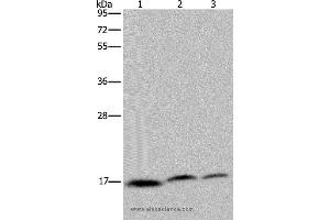 Western blot analysis of Jurkat, Hela and K562 cell, using NDUFAF4 Polyclonal Antibody at dilution of 1:350 (NDUFAF4 抗体)