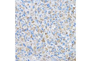 Immunohistochemistry (IHC) image for anti-Family with Sequence Similarity 3, Member D (FAM3D) (AA 24-204) antibody (ABIN7267116)