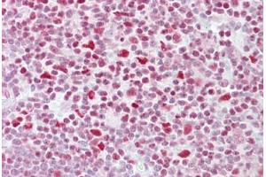 Anti-NFATC3 antibody IHC staining of human thymus. (NFATC3 抗体  (AA 324-373))