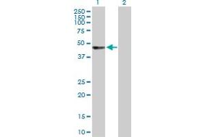 Western Blot analysis of UBASH3A expression in transfected 293T cell line by UBASH3A MaxPab polyclonal antibody. (UBASH3A 抗体  (AA 1-451))