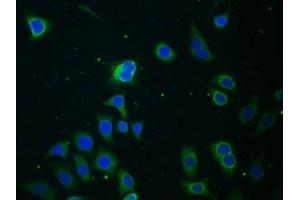 Detection of MAOB in Human HepG2 cell using Polyclonal Antibody to Monoamine Oxidase B (MAOB) (Monoamine Oxidase B 抗体  (AA 206-505))