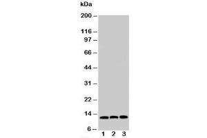 Western blot testing of MIF antibody and Lane 1:  HeLa;  2: COLO320;  3: MM231 cell lysate (MIF 抗体  (C-Term))