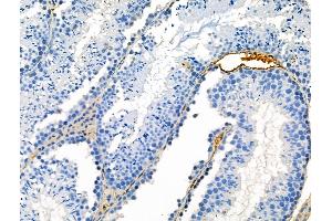ABIN7093245 and ABIN7097262 at 1/100 staining Mouse testis tissue by IHC-P. (DPYSL2 抗体  (pSer522))