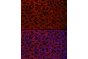 Immunofluorescence analysis of rat liver cells using H/GOX Rabbit pAb (ABIN6131795, ABIN6141599, ABIN6141600 and ABIN6222127) at dilution of 1:100 (40x lens). (HAO1 抗体  (AA 1-370))