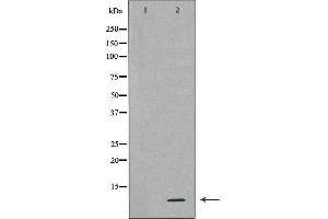 Western blot analysis of extracts of HL-60 , using RPS27A antibody. (RPS27A 抗体  (Internal Region))