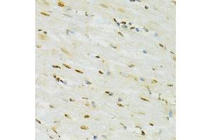 Immunohistochemistry of paraffin-embedded rat heart using ADAR antibody. (ADAR 抗体  (AA 150-250))