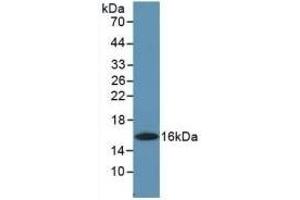 Detection of Recombinant GMCSF, Human using Polyclonal Antibody to Colony Stimulating Factor 2, Granulocyte Macrophage (GM-CSF) (GM-CSF 抗体  (AA 18-144))