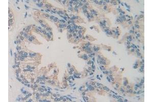 Immunohistochemistry (IHC) image for anti-Acetyl-CoA Acetyltransferase 2 (ACAT2) (AA 1-397) antibody (ABIN7435556)