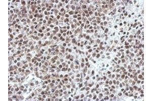 IHC-P Image Immunohistochemical analysis of paraffin-embedded Hela xenograft, using OCT1, antibody at 1:750 dilution. (POU2F1 抗体)