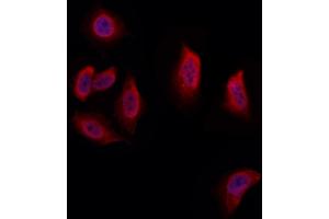 ABIN6265871 and ABIN6273338 staining Hela by IF/ICC.