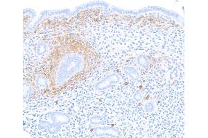 Immunohistochemistry (IHC) image for anti-Syndecan 1 (SDC1) (AA 23-251) antibody (ABIN7795740)