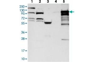 Western blot analysis of Lane 1: RT-4, Lane 2: U-251 MG, Lane 3: Human Plasma, Lane 4: Liver, Lane 5: Tonsil with BANK1 polyclonal antibody .