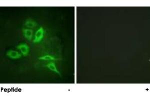 Immunofluorescence analysis of A-549 cells, using S1PR1 polyclonal antibody . (S1PR1 抗体)