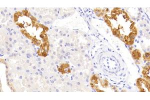 Detection of DR5 in Human Kidney Tissue using Polyclonal Antibody to Death receptor 5 (DR5)
