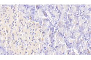 Detection of DR5 in Human Pancreas Tissue using Polyclonal Antibody to Death receptor 5 (DR5)