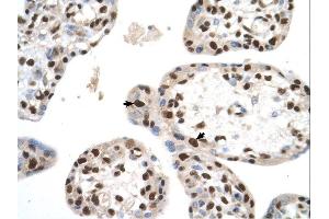 SETD2 antibody was used for immunohistochemistry at a concentration of 4-8 ug/ml. (SETD2 抗体  (N-Term))