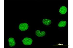 Immunofluorescence of purified MaxPab antibody to CBX5 on HeLa cell. (CBX5 抗体  (AA 1-191))