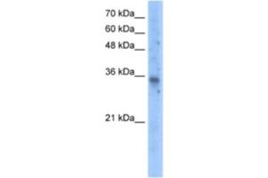 Western Blotting (WB) image for anti-Solute Carrier Family 25 (Mitochondrial Carrier, Graves Disease Autoantigen), Member 16 (SLC25A16) antibody (ABIN2462778) (SLC25A16 抗体)