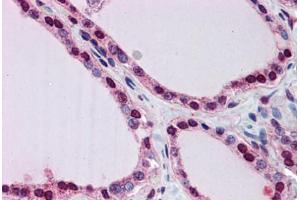 Human Thyroid: Formalin-Fixed, Paraffin-Embedded (FFPE) (Lipin 1 抗体  (AA 218-267))
