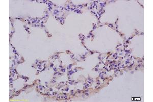 Formalin-fixed and paraffin embedded rat lung labeled with Anti-GRB10 Polyclonal Antibody, Unconjugated (ABIN680428) at 1:200 followed by conjugation to the secondary antibody and DAB staining (GRB10/14 (AA 501-594) 抗体)
