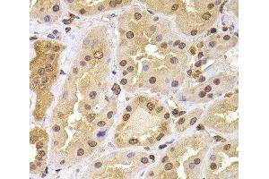 Immunohistochemistry of paraffin-embedded Human kidney using PHF21B Polyclonal Antibody at dilution of 1:100 (40x lens). (PHF21B 抗体)
