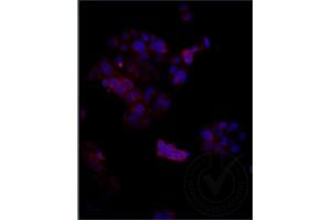 Independently Validated Antibody, image provided by Science Direct, badge number 029611:Formalin-fixed MCF7 cells labeled with Anti-Megalin Polyclonal Antibody, Cy3 Conjugated (ABIN750991) at 1:250 overnight at 4C. (LRP2 抗体  (AA 3401-3500))