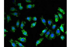 Immunofluorescent analysis of A549 cells using ABIN7145531 at dilution of 1:100 and Alexa Fluor 488-congugated AffiniPure Goat Anti-Rabbit IgG(H+L) (BACE1 抗体  (AA 46-155))