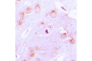 Immunohistochemistry (IHC) image for anti-Cytochrome P450, Family 17, Subfamily A, Polypeptide 1 (CYP17A1) (Center) antibody (ABIN7295468)