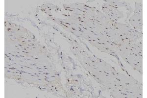 ABIN6263438 and ABIN6266721 at 1/100 staining Human gastric tissue by IHC-P.