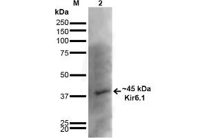 Western Blot analysis of Rat Brain showing detection of ~45 kDa Kir6. (KCNJ8 抗体  (AA 306-424) (FITC))
