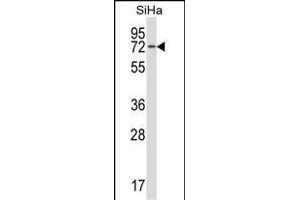 HSB Antibody (N-term) (ABIN657502 and ABIN2846527) western blot analysis in SiHa cell line lysates (35 μg/lane). (HSPA12B 抗体  (N-Term))