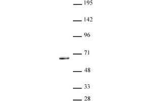 KLF5 antibody (pAb) tested by Western Blot. (KLF5 抗体  (N-Term))