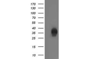 HEK293T cells were transfected with the pCMV6-ENTRY control (Left lane) or pCMV6-ENTRY CXorf26 (Right lane) cDNA for 48 hrs and lysed. (CXorf26 抗体)