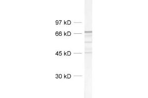 dilution: 1 : 1000, sample: rat brain homogenate (NEFL 抗体  (AA 1-284))