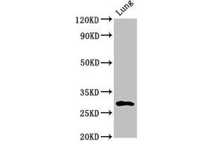 Western Blot Positive WB detected in: Rat lung tissue All lanes: SYNPR antibody at 3 μg/mL Secondary Goat polyclonal to rabbit IgG at 1/50000 dilution Predicted band size: 30, 32 kDa Observed band size: 30 kDa (Synaptoporin 抗体  (AA 199-265))
