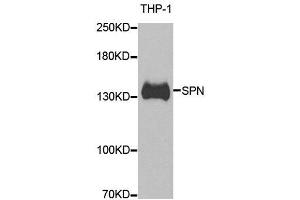 Western blot analysis of extracts of THP-1 cell line, using SPN antibody. (CD43 抗体)
